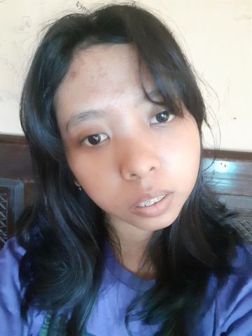 Rizkyana