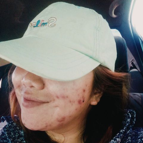 Kateykatep