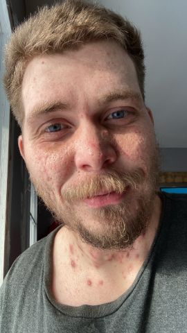 Canada420 is Single in Stratford, Prince Edward Island, 2