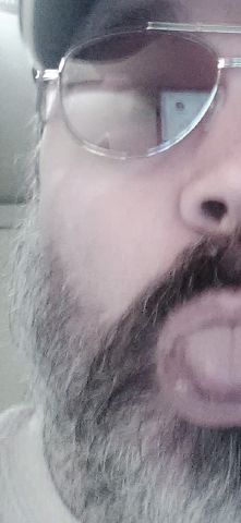 TheBaldOne
