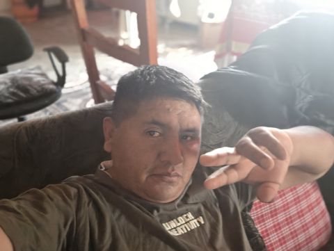 MnelsonTicona