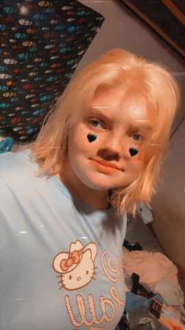 Kay_bites